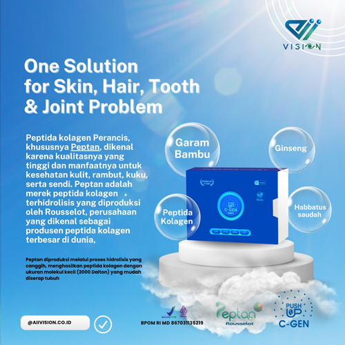 Aiivision International Indonesia 001 – KILADS by EPOCHSTREAM